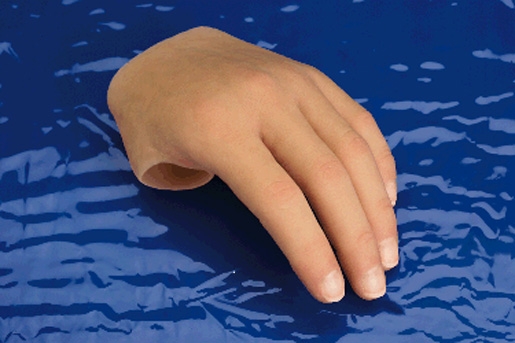 Silicon-Teilhand-Prothese