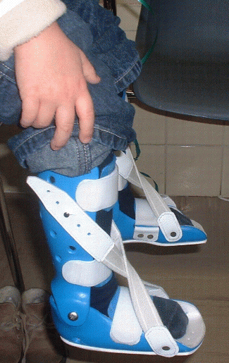 Dynamische Spitzfußschiene