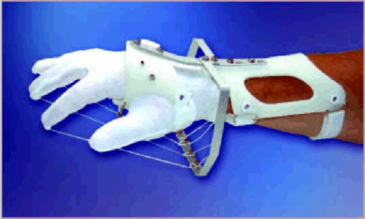 Dynamische Handgelenksorthese DAHO Typ 3