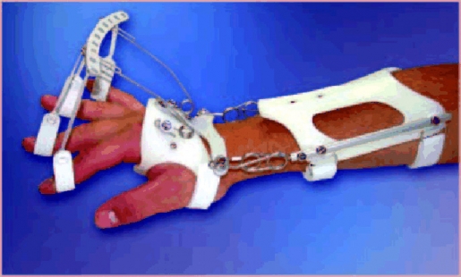 Dynamische Handgelenksorthese DAHO Typ 2.4