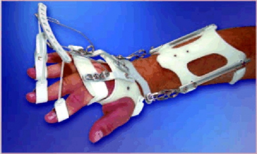 Dynamische Handgelenksorthese DAHO Typ 2.3