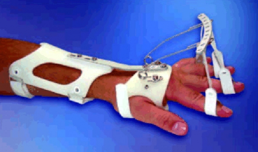 Dynamische Handgelenksorthese DAHO Typ 2.2