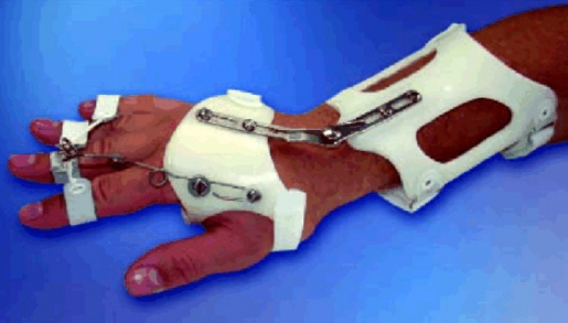 Dynamische Handgelenksorthese DAHO Typ 1