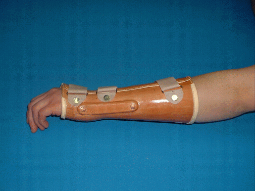 Mittelhand-Unterarmhülse