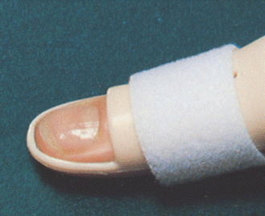 Stack'sche Fingerschiene